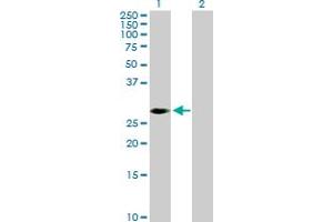 Western Blot analysis of PRKAB2 expression in transfected 293T cell line by PRKAB2 MaxPab polyclonal antibody. (PRKAB2 抗体  (AA 1-272))