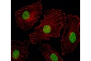 Fluorescent image of HUVEC cells stained with ISL2 antibody. (ISL2 抗体  (AA 1-30))