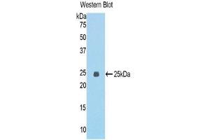 Western Blotting (WB) image for anti-Epithelial Cell Transforming Sequence 2 Oncogene (ECT2) (AA 453-647) antibody (ABIN1858683) (ECT2 抗体  (AA 453-647))