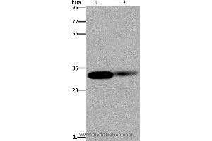Western blot analysis of Human kidney and mouse lung tissue, using LIMS1 Polyclonal Antibody at dilution of 1:200 (LIMS1 抗体)