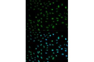 Immunofluorescence analysis of MCF7 cell using ELAVL1 antibody. (ELAVL1 抗体  (AA 1-326))