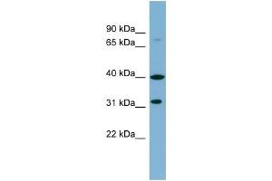 WB Suggested Anti-C9orf4 Antibody Titration:  0. (Ferric-Chelate Reductase 1 Like (FRRS1L) (Middle Region) 抗体)