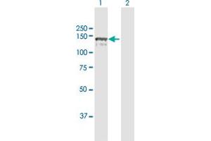 Western Blot analysis of CC2D1A expression in transfected 293T cell line by CC2D1A MaxPab polyclonal antibody. (CC2D1A 抗体  (AA 1-951))