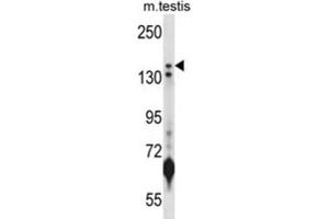 Western Blotting (WB) image for anti-Lysine (K)-Specific Demethylase 5B (KDM5B) antibody (ABIN2998014)