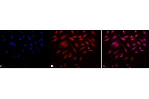 Immunocytochemistry/Immunofluorescence analysis using Rabbit Anti-Rab4 Polyclonal Antibody (ABIN361840 and ABIN361841).