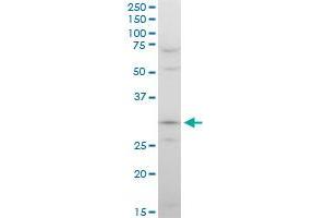 STOM polyclonal antibody (A01), Lot # 060717JCS1. (Stomatin 抗体  (AA 59-142))