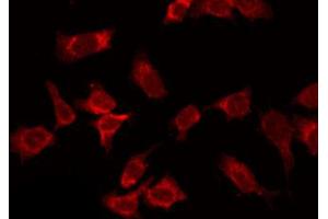 ABIN6266872 staining HepG2 by IF/ICC. (COL14A1 抗体  (C-Term))