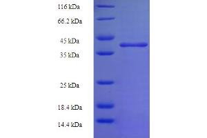 SDS-PAGE (SDS) image for N-6 Adenine-Specific DNA Methyltransferase 2 (Putative) (N6AMT2) (AA 2-214) protein (His-SUMO Tag) (ABIN5711529)
