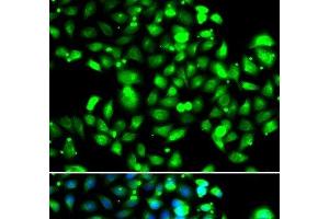 Immunofluorescence analysis of U2OS cells using GBP1 Polyclonal Antibody (GBP1 抗体)