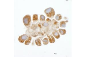 Immunohistochemistry (IHC) image for anti-DEAD (Asp-Glu-Ala-Asp) Box Polypeptide 3, X-Linked (DDX3X) (AA 1-50) antibody (ABIN7448520) (DDX3X 抗体  (AA 1-50))