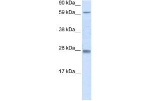 WB Suggested Anti-RHOX11 Antibody Titration:  0. (RHOX11 抗体  (N-Term))