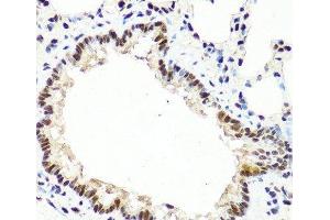 Immunohistochemistry of paraffin-embedded Rat lung using TET2 Polyclonal Antibody at dilution of 1:100 (40x lens). (TET2 抗体)