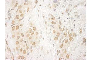 anti-Bromodomain PHD Finger Transcription Factor (BPTF) (AA 1350-1400) antibody