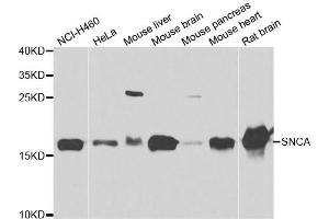 Western blot analysis of extracts of various cell lines, using SNCA antibody. (SNCA 抗体)