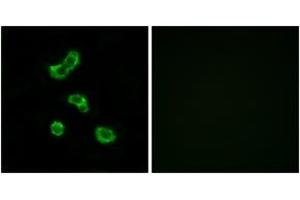 Immunofluorescence analysis of MCF7 cells, using CA5B Antibody. (CA5B 抗体  (AA 241-290))