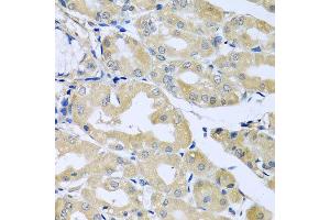 Immunohistochemistry of paraffin-embedded human stomach using HS1BP3 antibody at dilution of 1:100 (x40 lens). (HS1BP3 抗体)