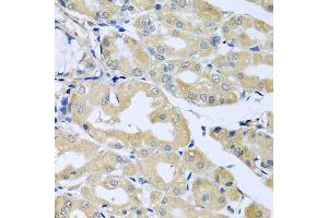 Immunohistochemistry of paraffin-embedded human stomach using HS1BP3 antibody at dilution of 1:100 (x40 lens).