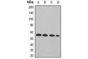Western blot analysis of Cyclin A2 expression in Hela (A), MCF7 (B), mouse spleen (C), rat thymus (D) whole cell lysates. (Cyclin A 抗体)