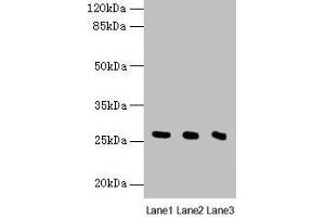 Western blot All lanes: Nqo2 antibody at 8 μg/mL Lane 1: Rat heart tissue Lane 2: Mouse liver tissue Lane 3: Mouse kidney tissue Secondary Goat polyclonal to rabbit IgG at 1/10000 dilution Predicted band size: 27 kDa Observed band size: 27 kDa (NQO2 抗体  (AA 1-231))