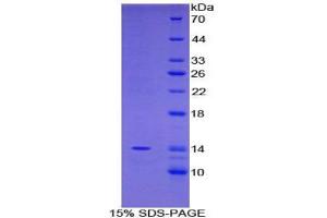 SDS-PAGE (SDS) image for Family with Sequence Similarity 19 (Chemokine (C-C Motif)-Like), Member A2 (FAM19A2) protein (ABIN3009312)