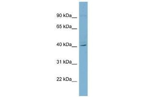 RFPL3 antibody used at 0. (RFPL3 抗体  (Middle Region))