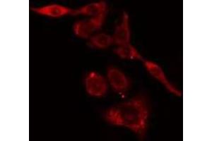 ABIN6275778 staining LOVO cells by IF/ICC. (KRT37,38 抗体)