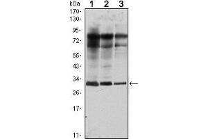 Western Blotting (WB) image for anti-RAB25, Member RAS Oncogene Family (RAB25) antibody (ABIN969377)