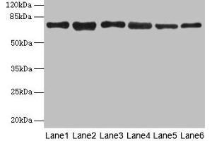 Western blot All lanes: TMCC1 antibody at 1 μg/mL Lane 1: MCF-7 whole cell lysate Lane 2: Mouse liver tissue Lane 3: Mouse kidney tissue Lane 4: HL60 whole cell lysate Lane 5: K562 whole cell lysate Lane 6: U937 whole cell lysate Secondary Goat polyclonal to rabbit IgG at 1/10000 dilution Predicted band size: 73, 54 kDa Observed band size: 73 kDa (TMCC1 抗体  (AA 51-300))