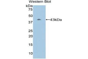 Detection of Recombinant C8b, Mouse using Polyclonal Antibody to Complement Component 8b (C8b) (C8B 抗体  (AA 161-503))