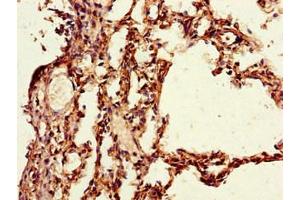Immunohistochemistry of paraffin-embedded human lung tissue using ABIN7163786 at dilution of 1:100 (PAIP2 抗体  (AA 1-127))