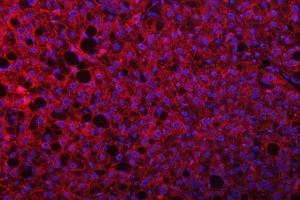 IF analysis of SEPTIN9 using anti-SEPTIN9 antibody (ABIN7600104). (Septin 9 抗体  (AA 15-282))