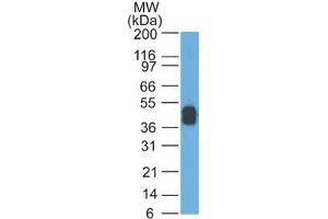 Western Blot Analysis of A431 cells using Cytokeratin, LMW Mouse Monoclonal Antibody (AE-1). (Keratin 77 抗体)