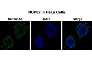 Immunofluorescent staining of HeLa cells with NUP62 polyclonal antibody  at 0. (NUP62 抗体  (N-Term))