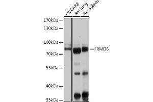 Western blot analysis of extracts of various cell lines, using FRMD6 antibody (ABIN6132194, ABIN6140773, ABIN6140774 and ABIN6225347) at 1:1000 dilution. (FRMD6 抗体  (AA 405-614))