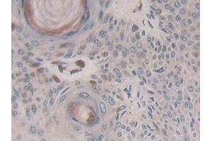 Immunohistochemistry (IHC) image for anti-Kinesin Family Member 18A (KIF18A) (AA 1-453) antibody (ABIN7436060)