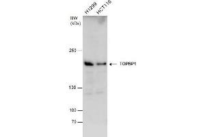 WB Image TOPBP1 antibody detects TOPBP1 protein by western blot analysis. (TOPBP1 抗体  (Internal Region))