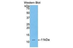 Western Blotting (WB) image for anti-CD3d Molecule, delta (CD3-TCR Complex) (CD3D) (AA 22-103) antibody (ABIN3205926) (CD3D 抗体  (AA 22-103))