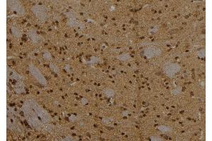 ABIN6273565 at 1/100 staining Rat brain tissue by IHC-P. (CPXCR1 抗体)