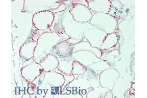 Immunohistochemistry (IHC) image for anti-Deoxyribonuclease II, Lysosomal (DNASE2) (AA 19-360) antibody (ABIN7443413)