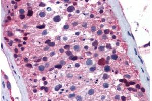 Human Testis: Formalin-Fixed, Paraffin-Embedded (FFPE) (FOXO1 抗体  (AA 373-422))