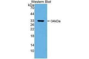 Detection of Recombinant ANXA5, Human using Monoclonal Antibody to Annexin V (ANXA5) (Annexin V 抗体  (AA 1-320))