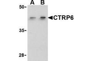 Western blot analysis of CTRP6 in HeLa cell lysate with AP30256PU-N CTRP6 antibody at (A) 1 and (B) 2 μg/ml. (CTRP6 抗体  (C-Term))
