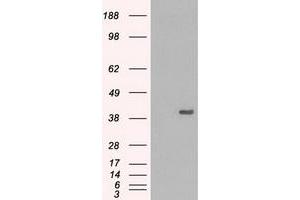HEK293T cells were transfected with the pCMV6-ENTRY control (Left lane) or pCMV6-ENTRY MAPK1 (Right lane) cDNA for 48 hrs and lysed. (ERK2 抗体)