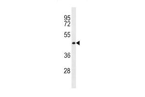 CWC27 Antibody (C-term) (ABIN1881243 and ABIN2843291) western blot analysis in MDA-M cell line lysates (35 μg/lane). (Cwc27 抗体  (C-Term))