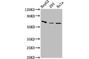 Western Blot Positive WB detected in: HepG2 whole cell lysate, 293 whole cell lysate, Hela whole cell lysate All lanes: CFI antibody at 3.