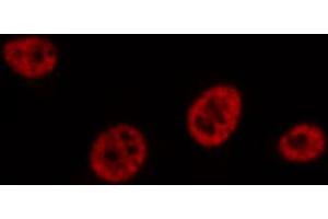 ABIN6267588 staining Hela by IF/ICC. (RUNX1 抗体  (pSer304))
