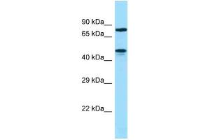 WB Suggested Anti-ZNF311 Antibody Titration: 1. (ZNF311 抗体  (N-Term))