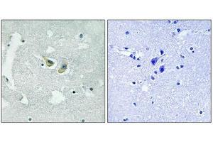 Immunohistochemical analysis of paraffin-embedded human brain tissue using p47 phox (Phospho-Ser345) antibody (left)or the same antibody preincubated with blocking peptide (right). (NCF1 抗体  (pSer345))