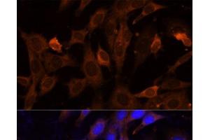 Immunofluorescence analysis of NIH-3T3 cells using VPS36 Polyclonal Antibody at dilution of 1:100 (40x lens). (VPS36 抗体)
