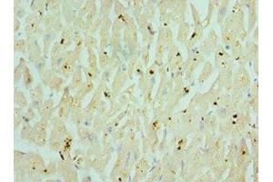 Immunohistochemistry of paraffin-embedded human heart tissue using ABIN7160351 at dilution of 1:100 (CHRM3 抗体  (AA 270-470))